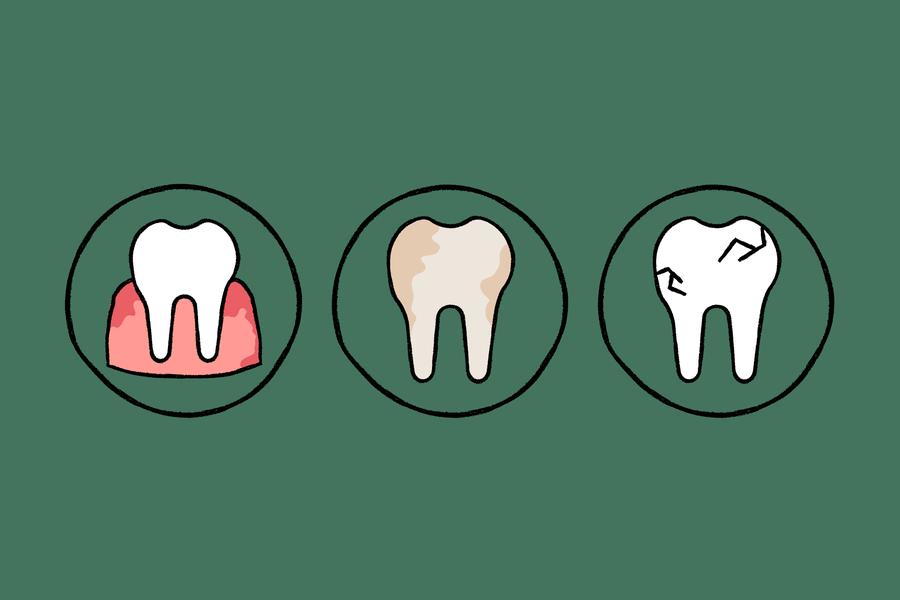 The image shows three circles, each depicting a tooth with a different condition:  Inflamed gums, Discoloration, and Cracks