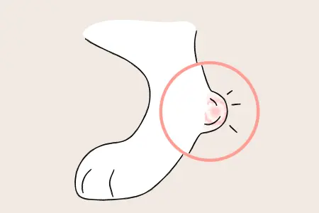 A drawing of a dog's foot with a circled area highlighting a red, inflamed spot on the heel