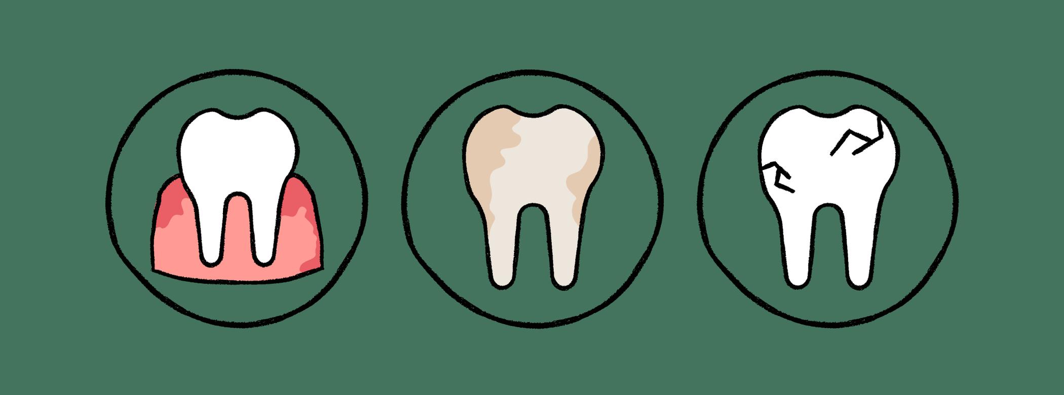 The image shows three circles, each depicting a tooth with a different condition: Inflamed gums, Discoloration, and Cracks